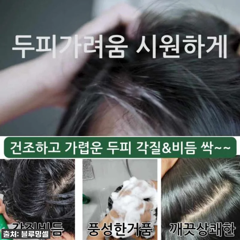 블루밍셀 두피케어 샴푸 찐후기: 지루 관련 이미지 2