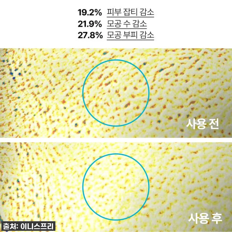 이니스프리 레티놀 시카 흔적 앰플 5 관련 이미지 4