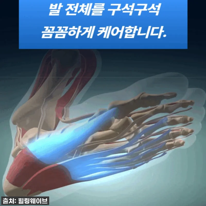 리커버풋 족저근막 이완기 저주파 발 관련 이미지 4