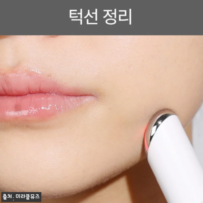 미라클뮤즈 고주파 부스터 디바이스 45g + 히알세라 리프팅 수딩크림, 홈케어 루틴에 담기 전 체크한 포인트 14 미라클뮤즈 고주파 부스터 디바이스 4 관련 이미지 3