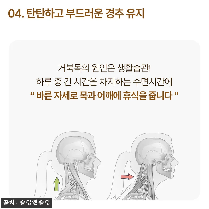슬립앤슬립 아이유 깊은잠 베개 S+S 관련 이미지 9